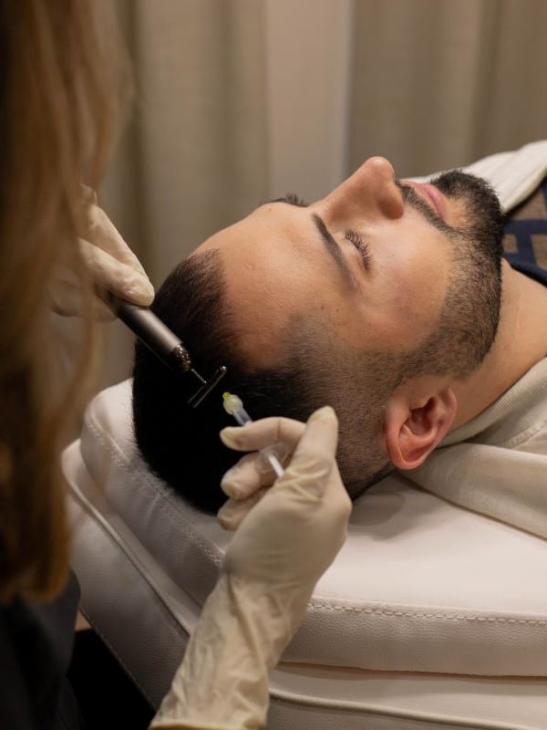 PRP hair loss treatment auckland