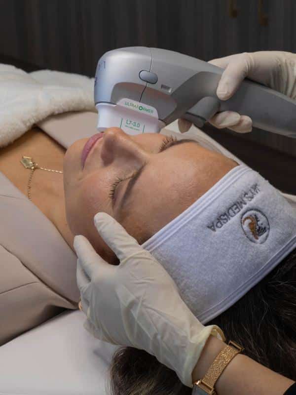 Ultraformer III HIFU treatments in auckland