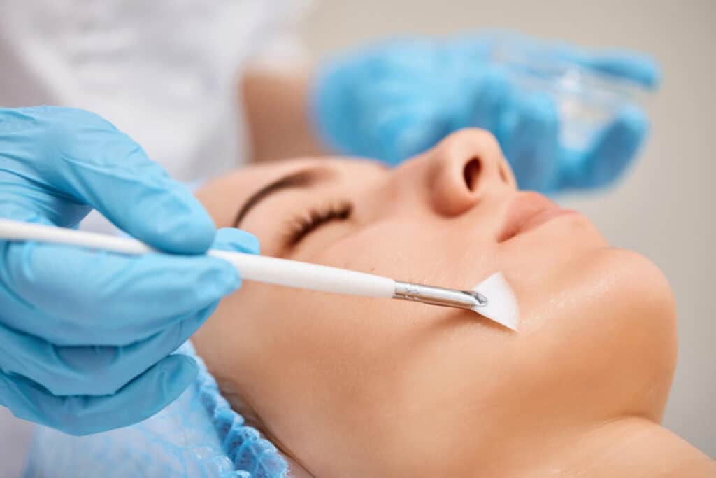 dermal peels