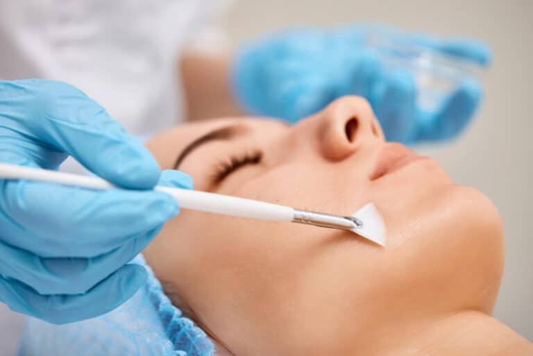 dermal peels