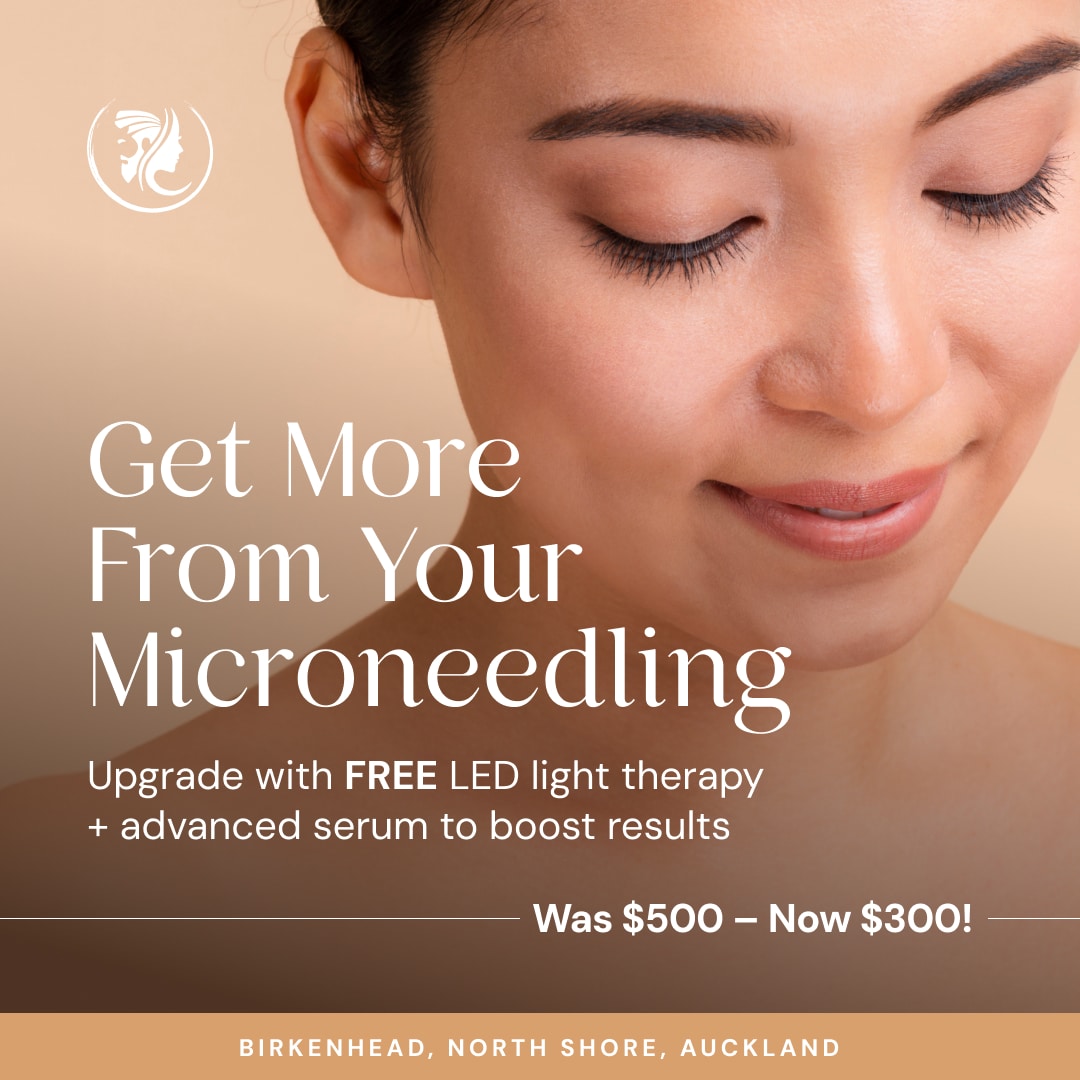 July-Promo-Microneedling